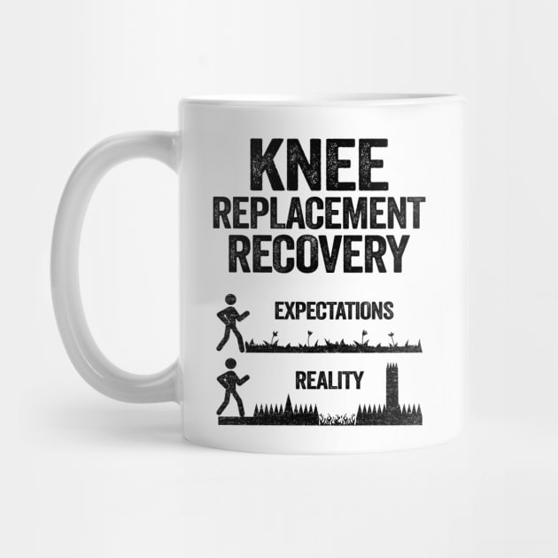 Knee Replacement Recovery Expectations Reality by Kuehni